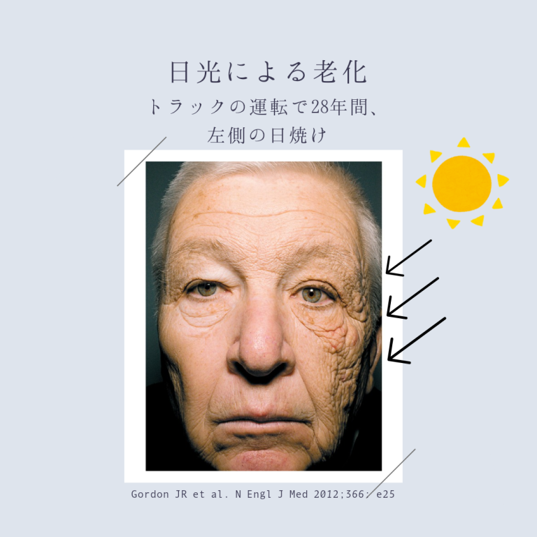 日光による皮膚老化 - 牧野皮膚科医院（公式）